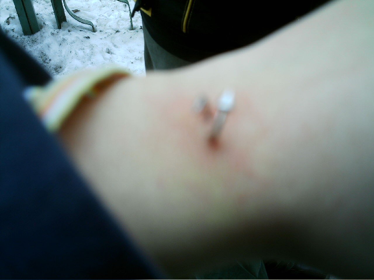 Cover for Skin